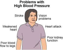 This is an image of a woman and the signs of high blood pressure problems are written around her.  They include vision problems, heart attack, poor kidney functions, stroke, weakened heart, and poor blood flow to the legs.