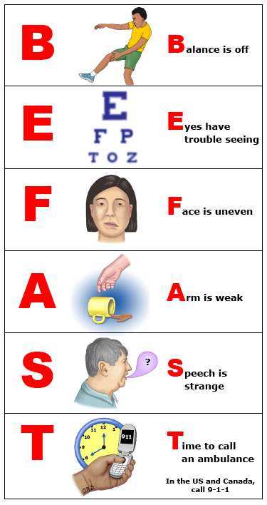 This is a figure titled BE FAST to help remember stroke symptoms. Legend: One way to help remember stroke symptoms is to think of the words "BE FAST." If a person shows any of these signs, call for an ambulance right away (in the US and Canada, call 9-1-1).