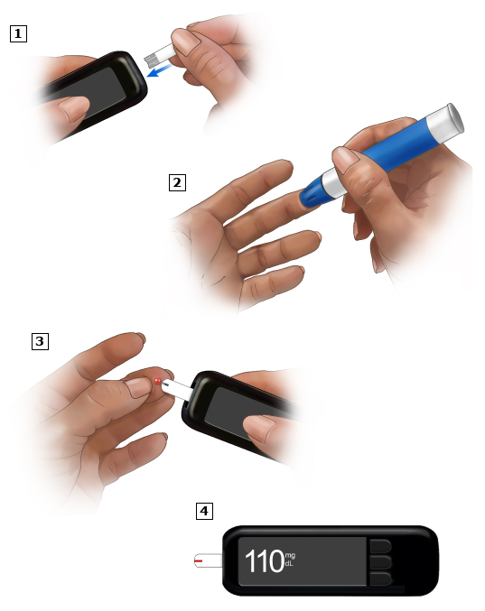 This is a figure titled Fingertip testing. Legend: Put a new test strip into the meter. Use a fresh, small needle or "lancet" to prick your fingertip. You might be able to prick other places, such as your forearm. Get a drop of blood. You might have to squeeze your finger to get the drop. Touch the edge of the test strip to the drop of blood. The meter will show your blood sugar level. Write this down so you can share it with your doctor or nurse.