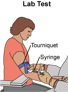 This is an image of a woman sitting in a chair with a tourniquet around her right arm.  A care provider is using a syringe to draw blood from her elbow area.