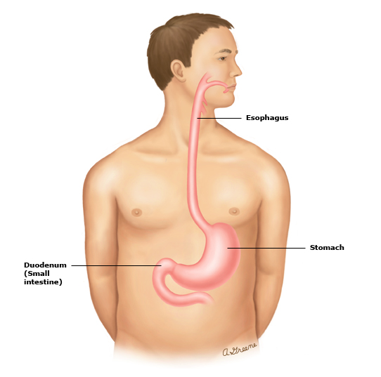 This is a figure titled Upper digestive tract. Legend: The upper digestive tract includes the esophagus (the tube that connects the mouth to the stomach), the stomach, and the duodenum (the first part of the small intestine).